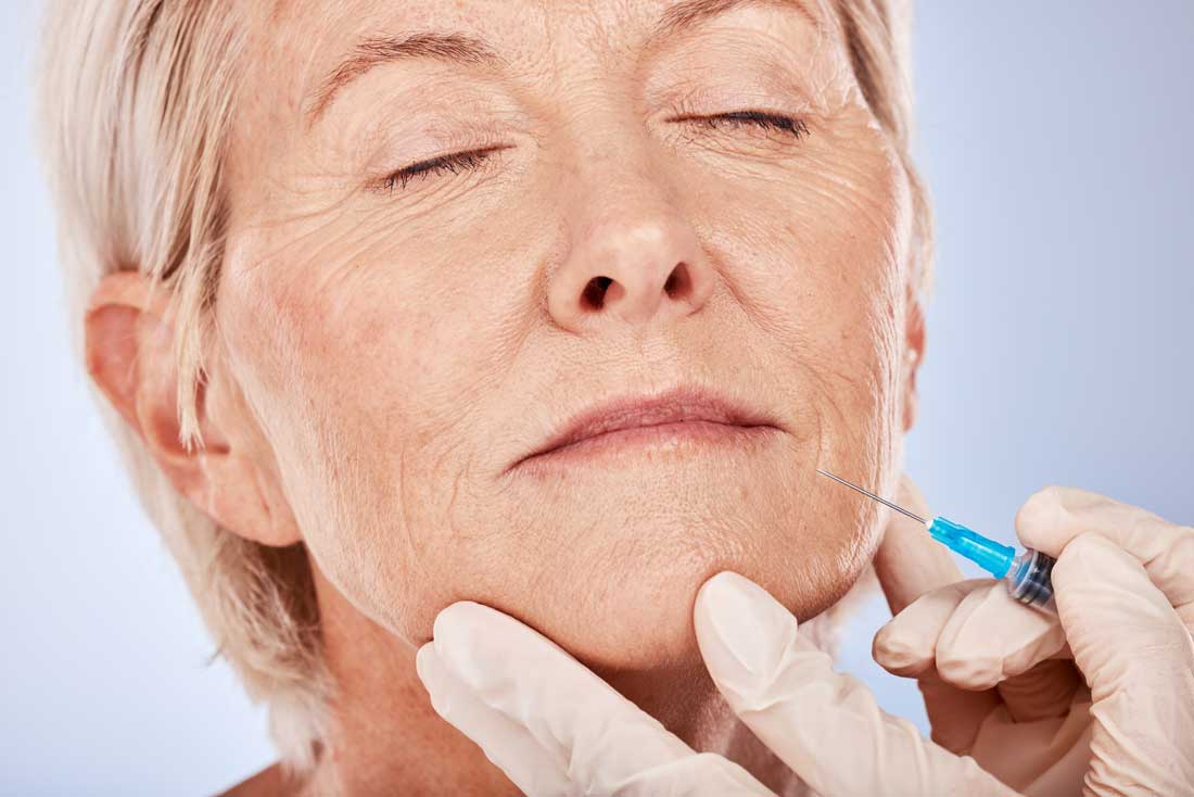 Precision dermal filler injection for facial contouring