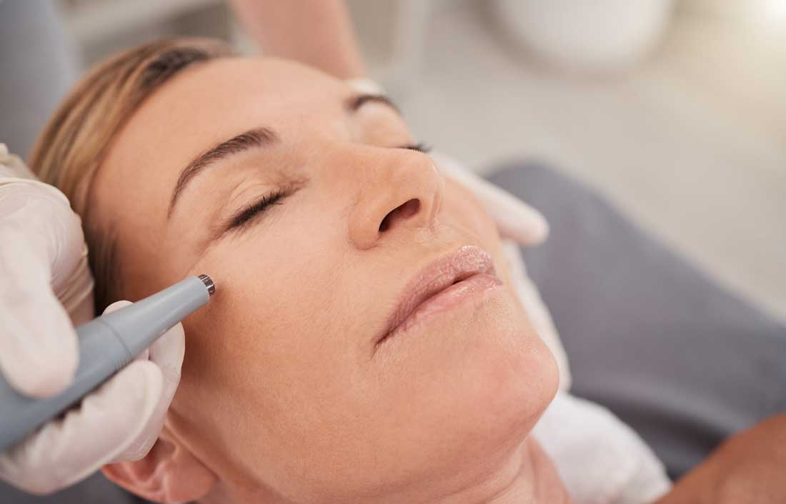 Client receiving personalized microneedling treatment at Glow Med Spa
