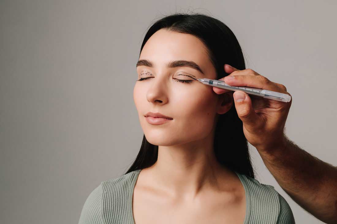 Woman receiving upper blepharoplasty eyelid treatment